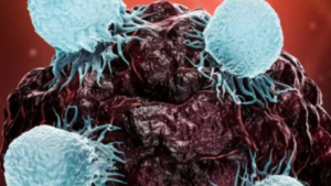 Door Lymph&Co gefinancierd onderzoek onthult hoe lymfoom het immuunsysteem ontwijkt